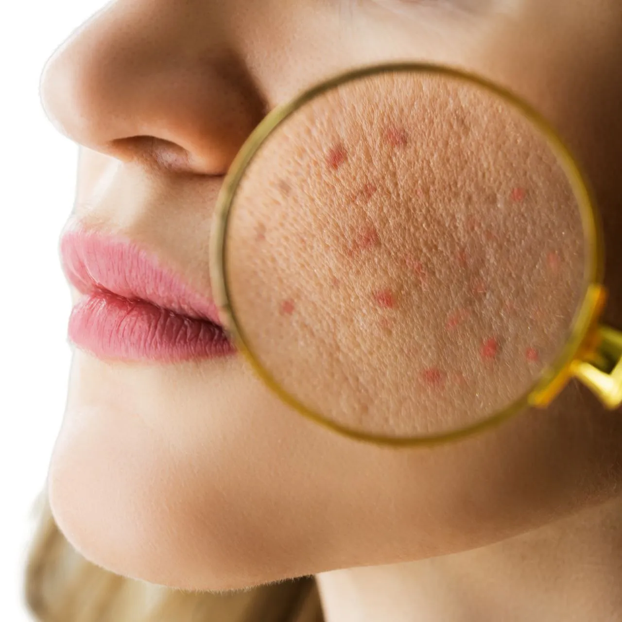 علاج مشاكل البشرة