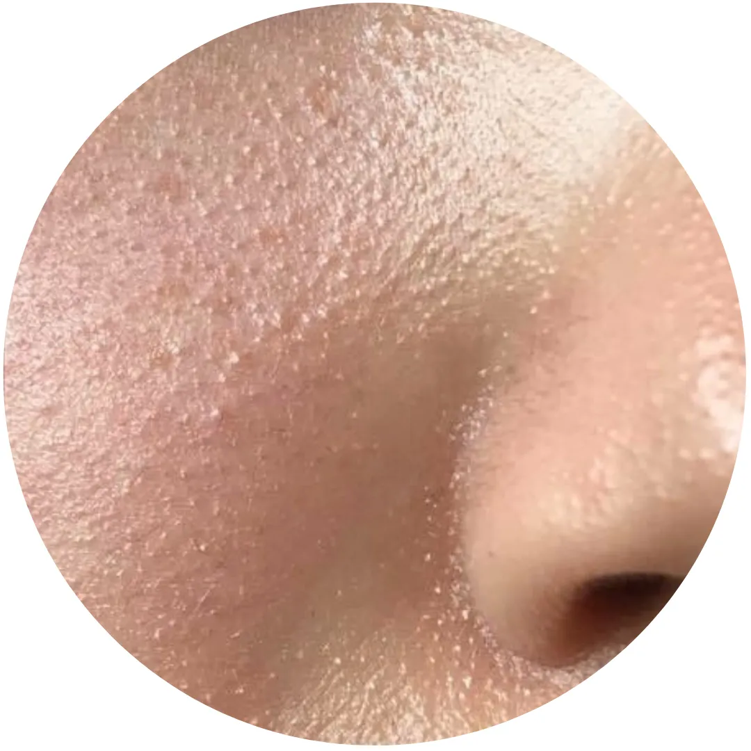 المسامات . الزيوان