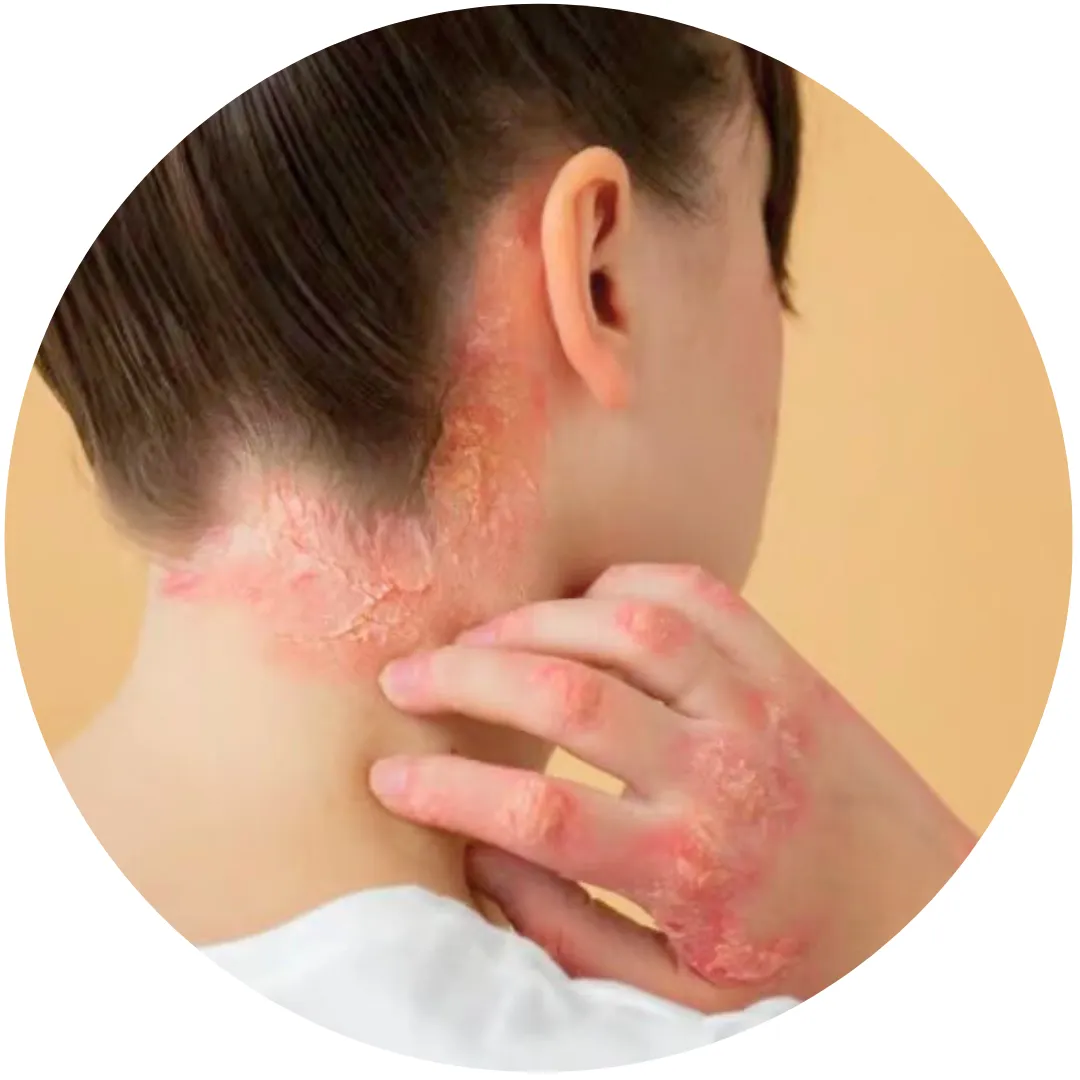 بكجات علاج مشاكل البشرة